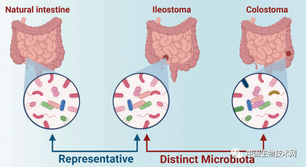 手术造口探索小肠微生物组