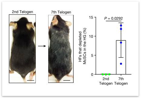 告别染发剂？Nature重磅：科学家发现白发可逆变黑的“开关”！